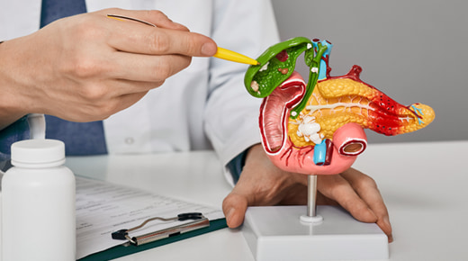 Cholecystectomy