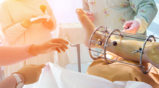 Joint Replacement Surgery