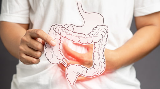 Inflammatory Bowel Disease