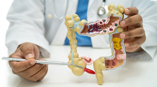Anal Fissure: What It Is, Symptoms, & Causes