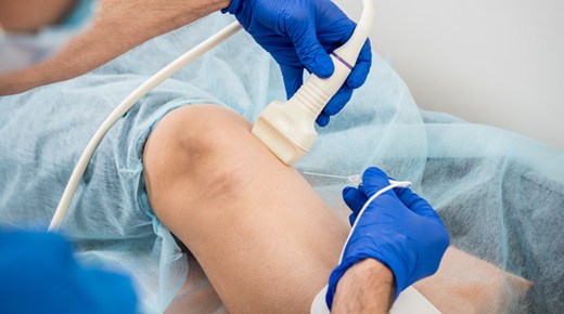 Endovascular Surgery
