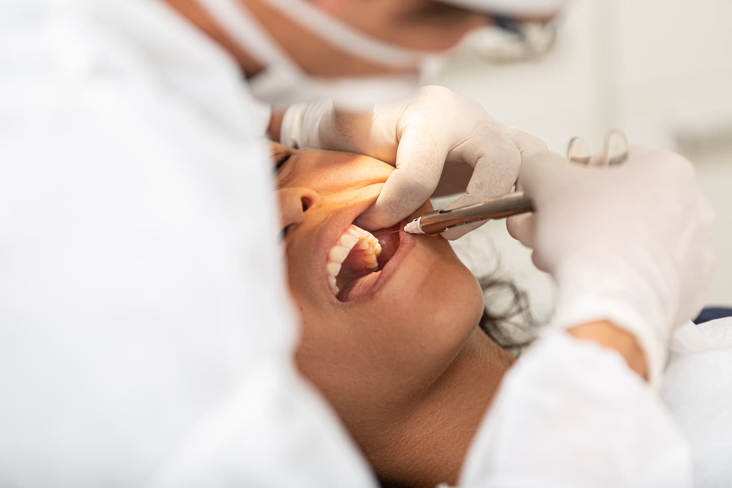 Wisdom Tooth Extraction